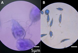 microscop tipografie